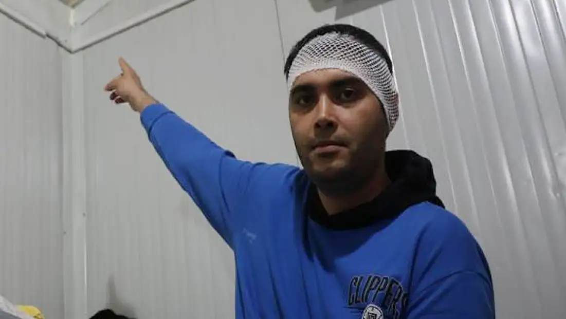 Konteynerde uykuda yaralandı