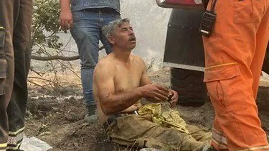 Yangında yaralanan orman işçisi yoğun bakıma alındı