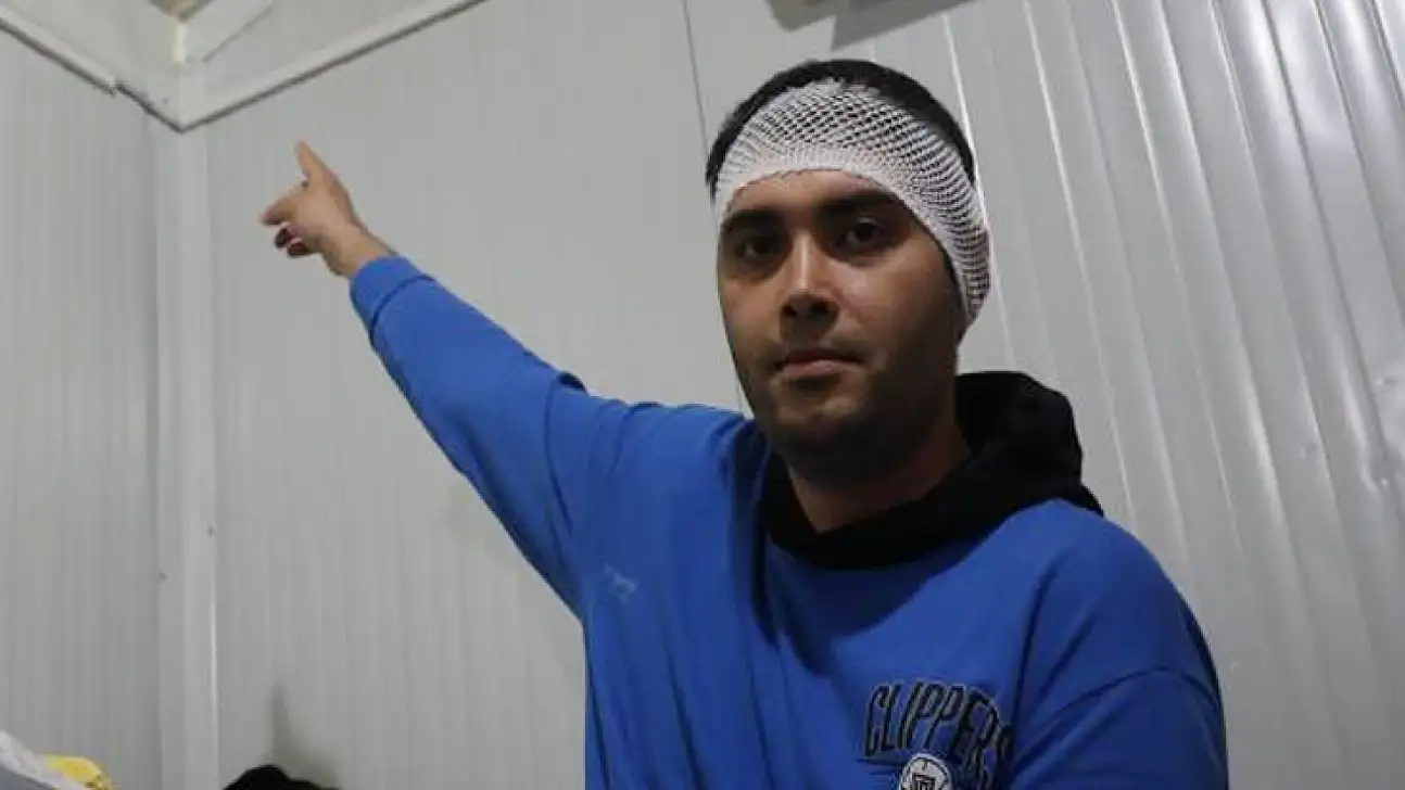 Konteynerde uykuda yaralandı