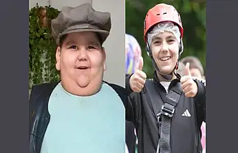 5 Yaşında 90 kiloydu, tedaviyle hayatı değişti