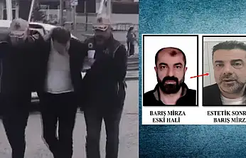 Katil zanlısı estetikle yüzünü değiştirdi: Yıllar sonra yakalandı
