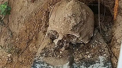 Fidan dikmek istediler insan kafatası  buldular