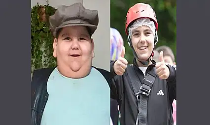 5 Yaşında 90 kiloydu, tedaviyle hayatı değişti