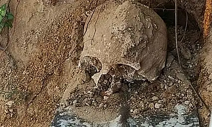 Fidan dikmek istediler insan kafatası  buldular