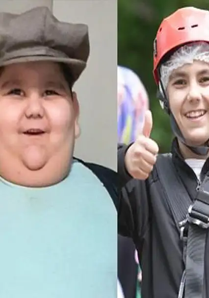 5 Yaşında 90 kiloydu, tedaviyle hayatı değişti