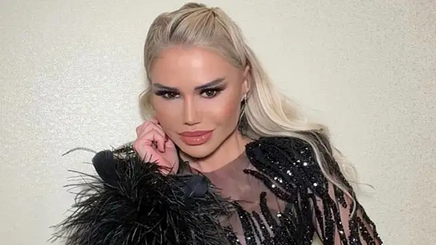 Ceylan'dan estetik açıklaması: Dolgu bana göre değil