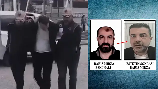 Katil zanlısı estetikle yüzünü değiştirdi: Yıllar sonra yakalandı