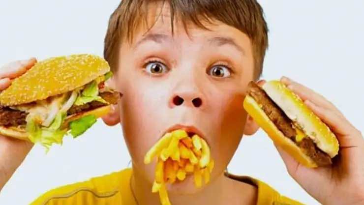 Obez çocukların sayısı ilk kez düşük kilolu çocukları geçti