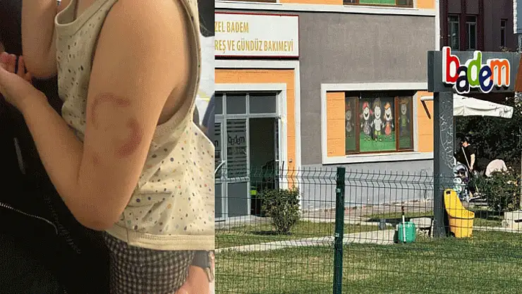 Özel kreşte skandal iddia: Öğretmen, öğrenciyi ısırarak uyandırdı