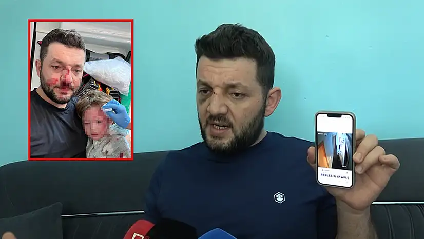 Baba ve 14 aylık kızına scotter ile saldıran zanlı için 36 yıla kadar hapsi istendi