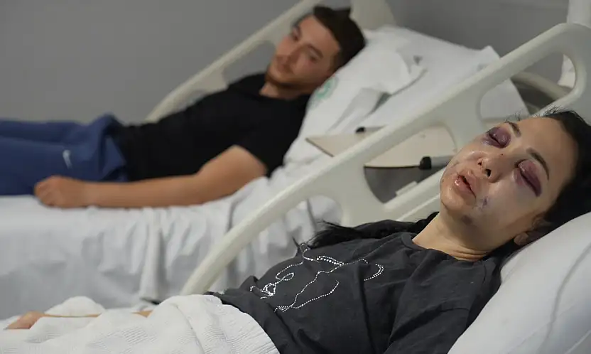 Anne ve oğlunu öldüresiye dövdüler: Kadın tanınmaz hale geldi