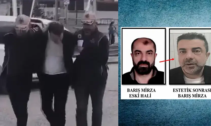 Katil zanlısı estetikle yüzünü değiştirdi: Yıllar sonra yakalandı